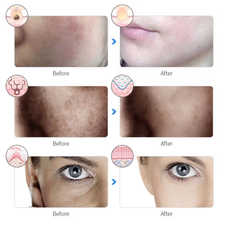 Dewy Glow Therapy Mask