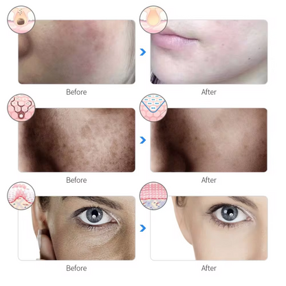 Dewy Glow Therapy Mask